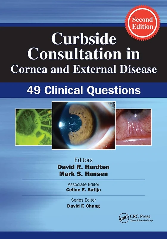 Curbside Consultation in Cornea and External Disease: 49 Clinical Questions (Curbside Consultation in Ophthalmology)