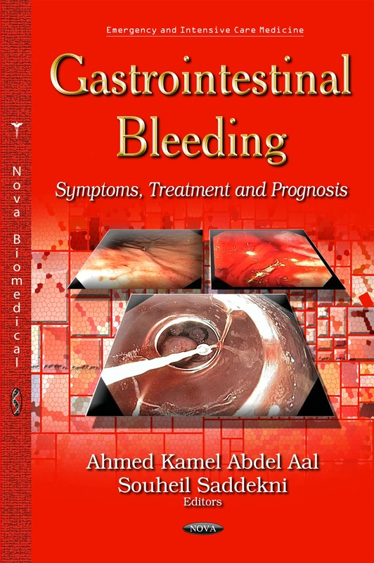 GASTROINTESTINAL BLEEDING SYMPTOMS T: Symptoms, Treatment & Prognosis (Emergency and Intensive Care Medicine)