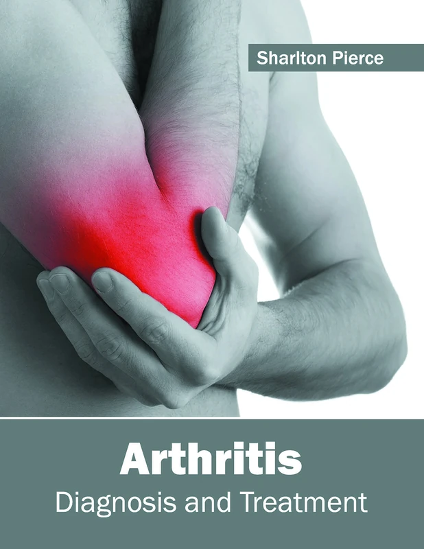 Arthritis: Diagnosis and Treatment