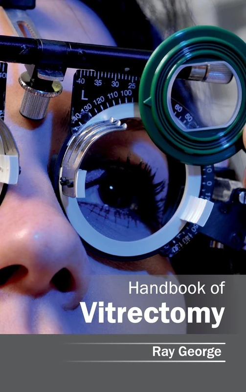 Handbook of Vitrectomy - Image 1