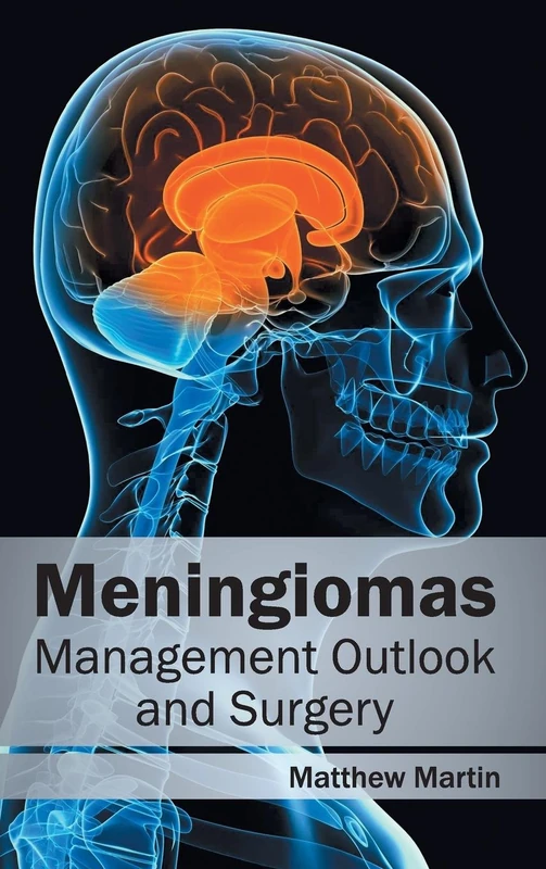 Meningiomas: Management Outlook and Surgery - Image 1
