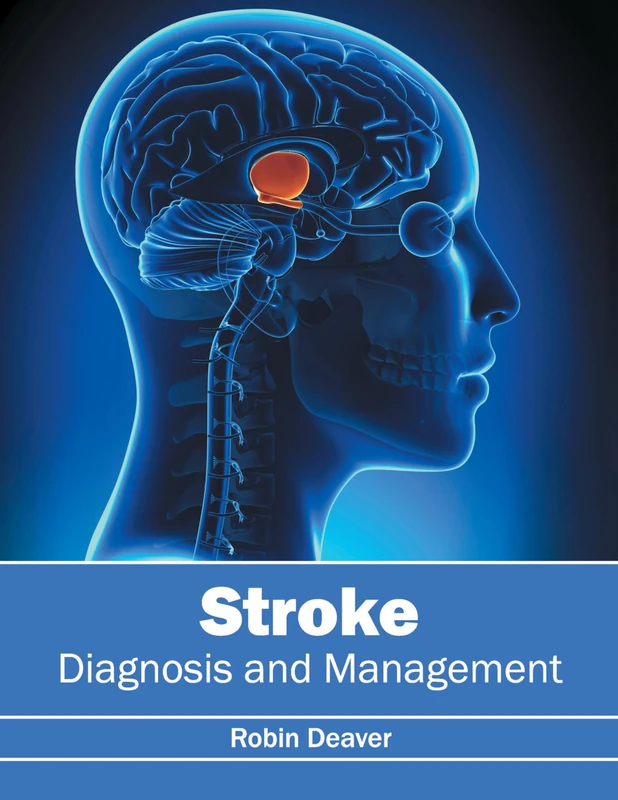 Stroke: Diagnosis and Management