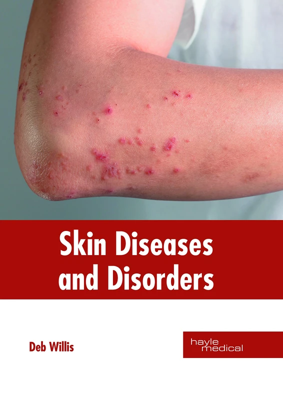 Skin Diseases and Disorders