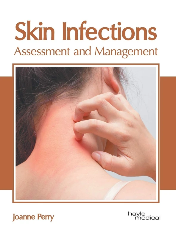 Skin Infections: Assessment and Management