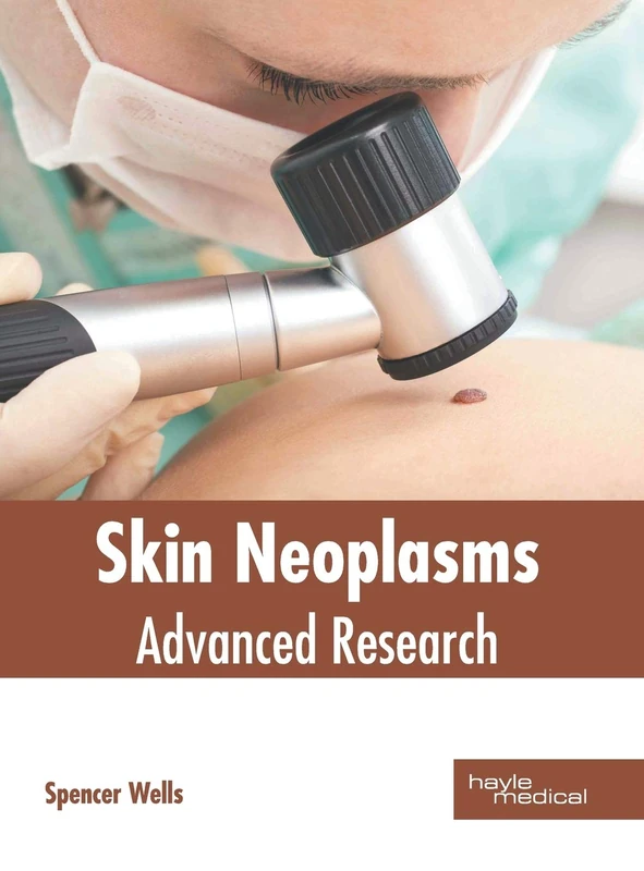 Hayle Medical Skin Neoplasms: Advanced Research Book
