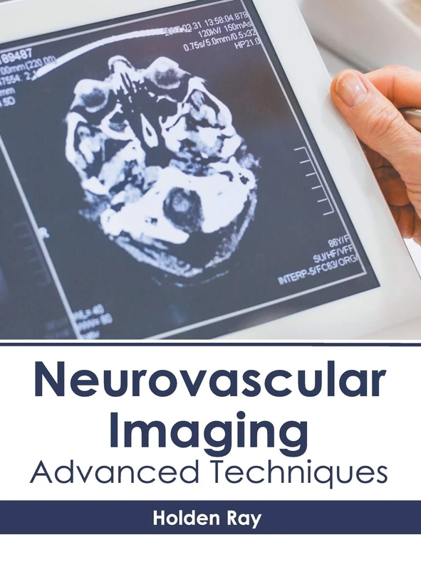 Neurovascular Imaging: Advanced Techniques