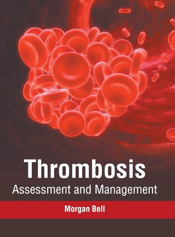 Thrombosis: Assessment and Management