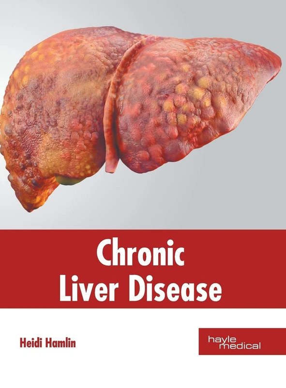 Chronic Liver Disease