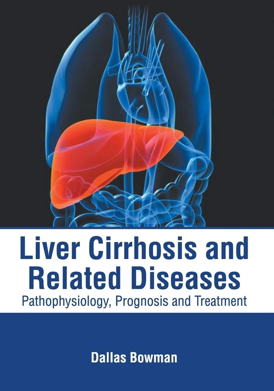 Liver Cirrhosis and Related Diseases: Pathophysiology, Prognosis and Treatment