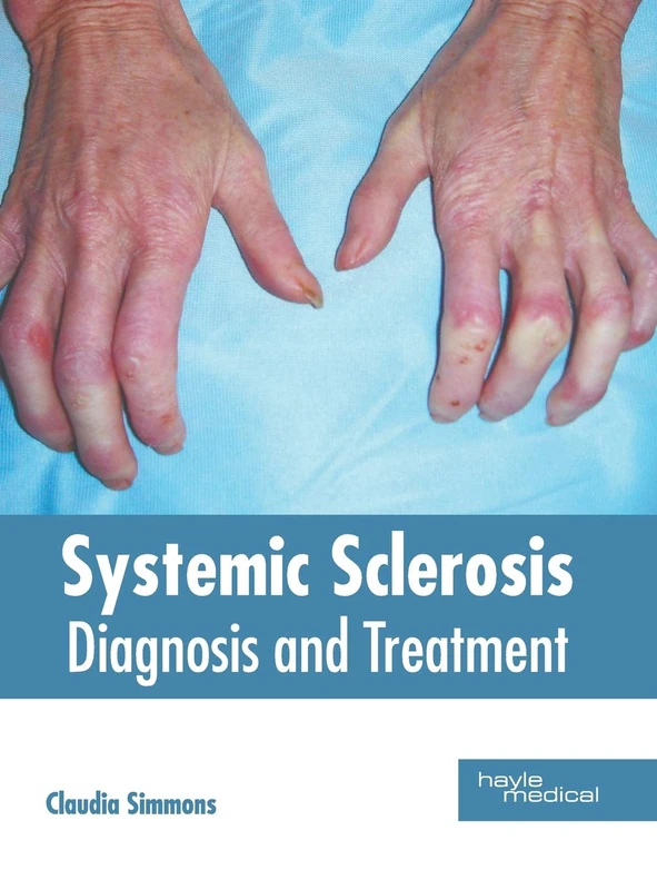 Systemic Sclerosis: Diagnosis and Treatment