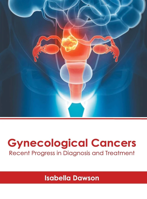 Gynecological Cancers: Recent Progress in Diagnosis and Treatment