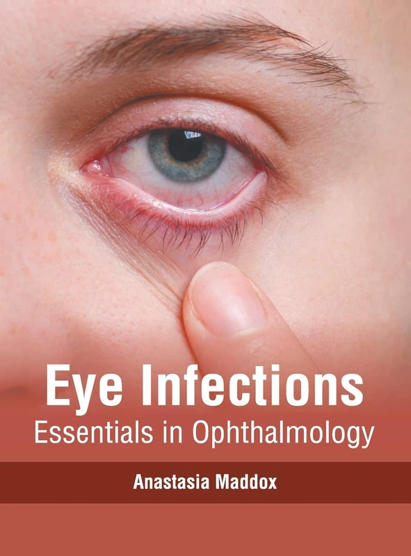 Eye Infections: Essentials in Ophthalmology
