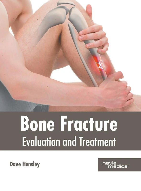 Hayle Medical - Bone Fracture: Evaluation and Treatment Book