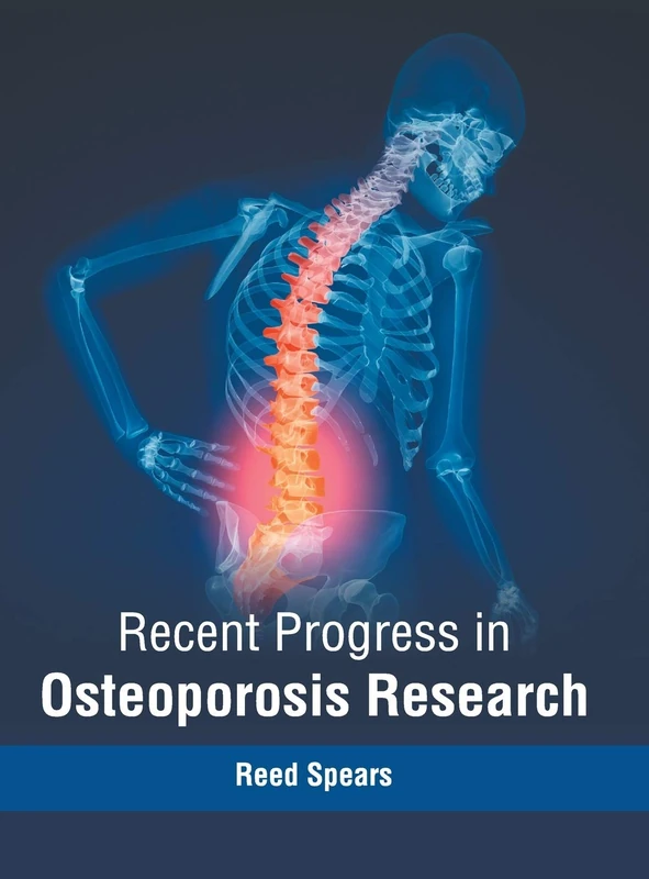 Recent Progress in Osteoporosis Research