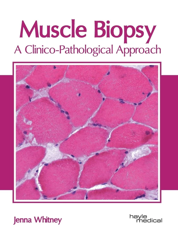Muscle Biopsy: A Clinico-Pathological Approach