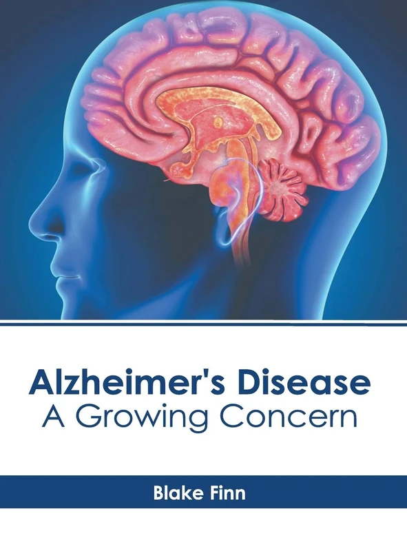 Alzheimer's Disease: A Growing Concern - Image 1