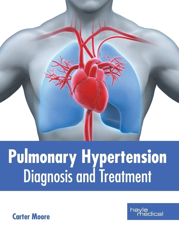 Pulmonary Hypertension: Diagnosis and Treatment