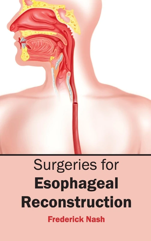 Surgeries for Esophageal Reconstruction - Image 1