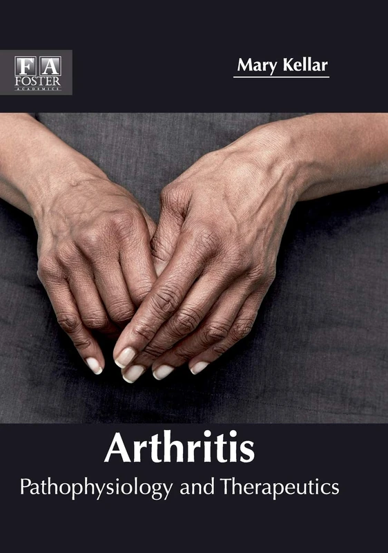 Arthritis: Pathophysiology and Therapeutics