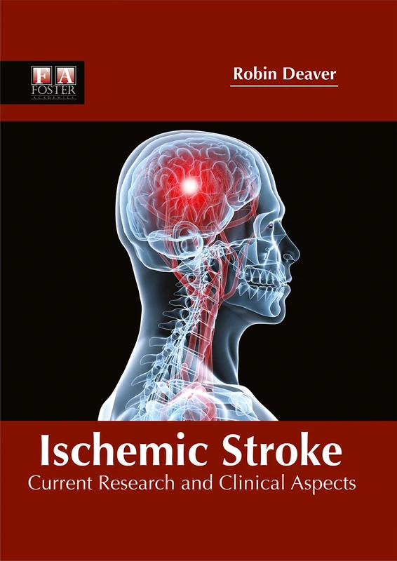 Ischemic Stroke: Current Research and Clinical Aspects