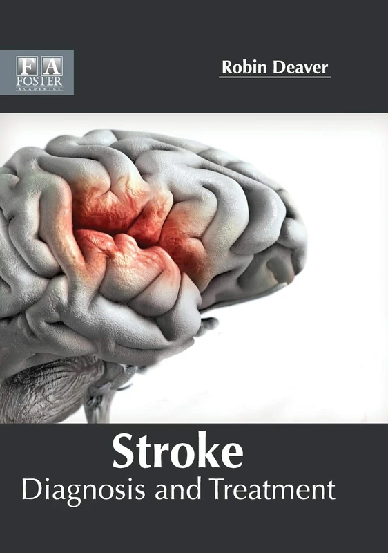 Stroke: Diagnosis and Treatment