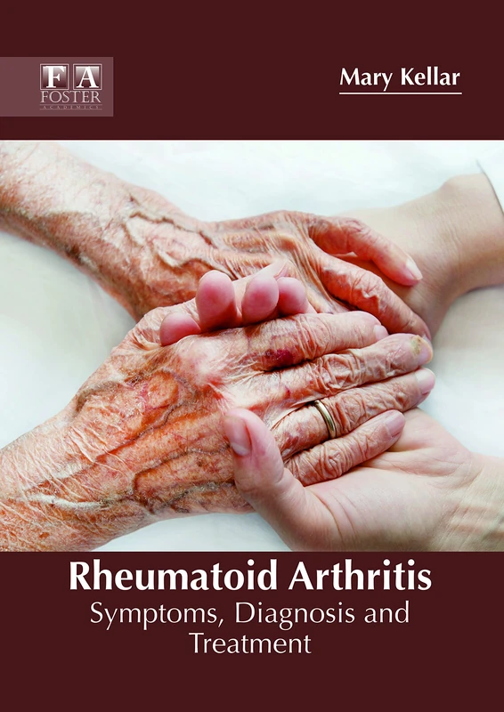 Rheumatoid Arthritis: Symptoms, Diagnosis and Treatment