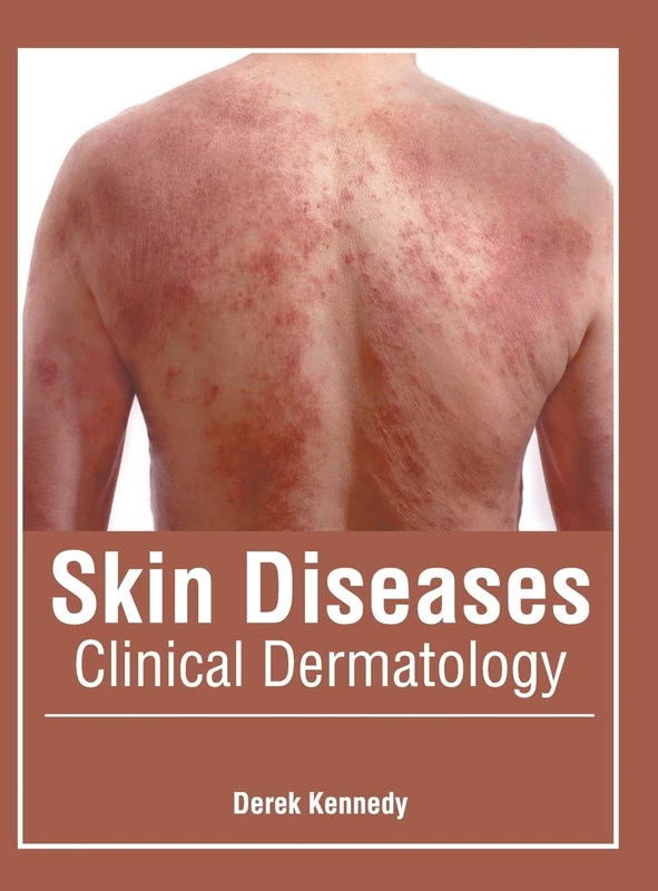 Skin Diseases: Clinical Dermatology