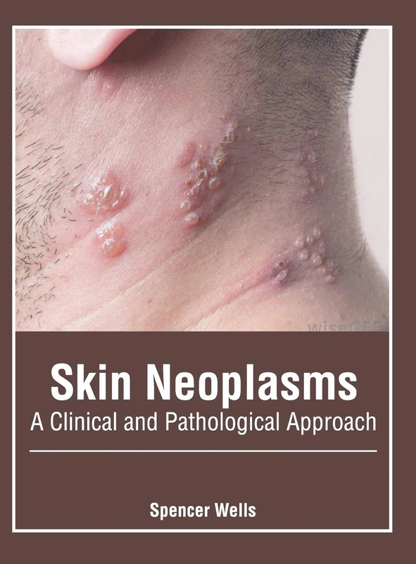 Skin Neoplasms: A Clinical and Pathological Approach