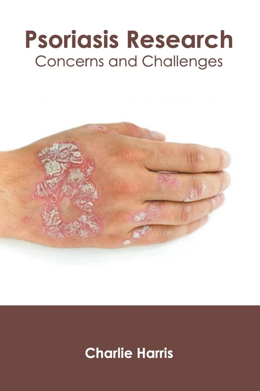 Psoriasis Research: Concerns and Challenges