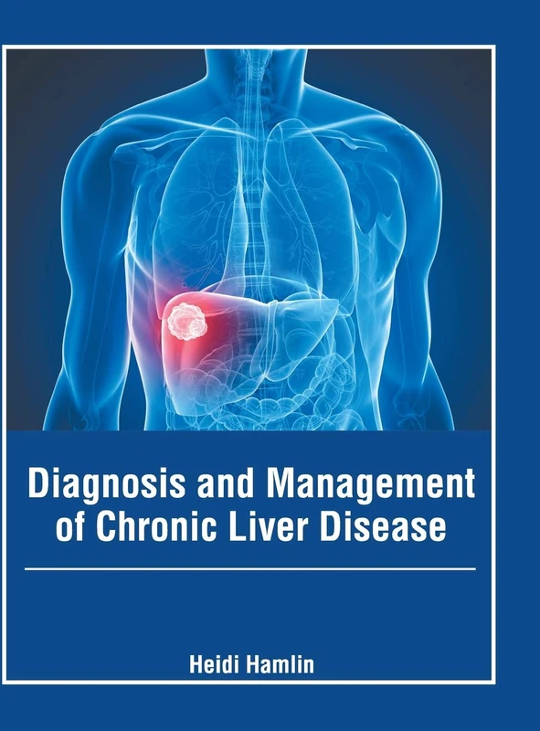 Diagnosis and Management of Chronic Liver Disease