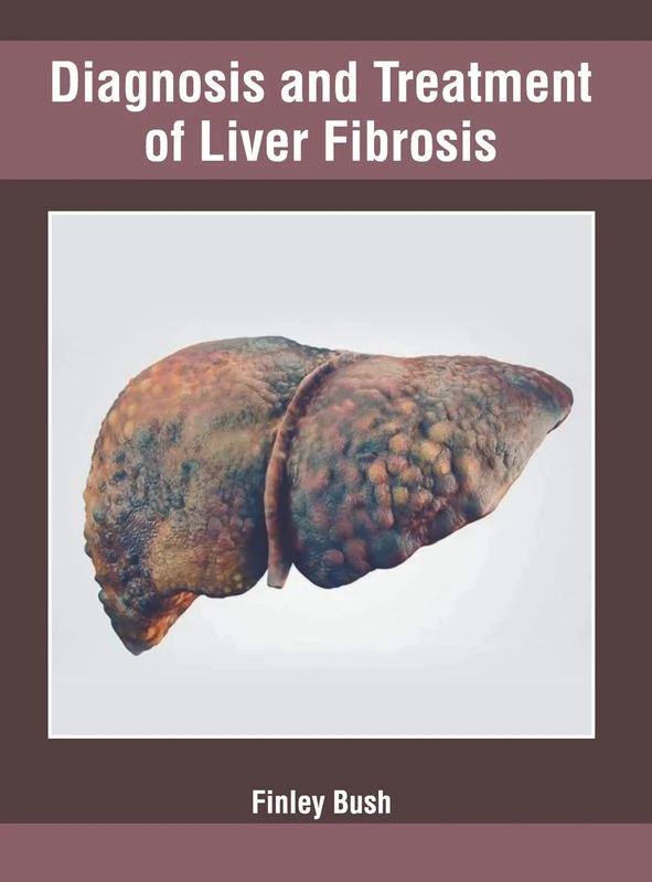 Diagnosis and Treatment of Liver Fibrosis