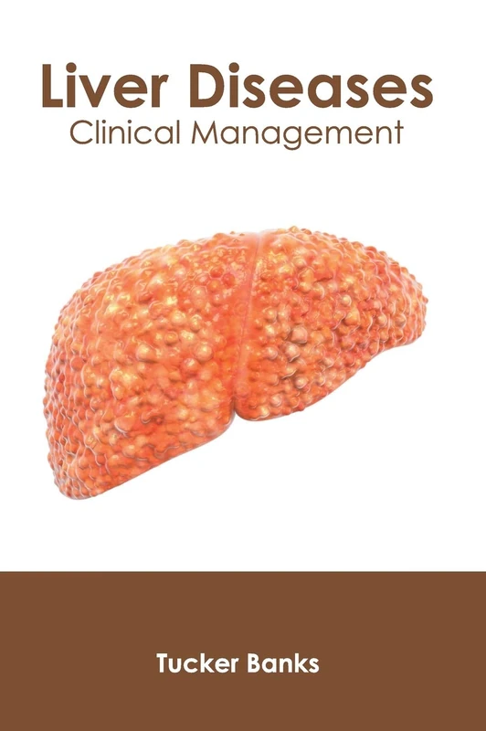 Liver Diseases: Clinical Management