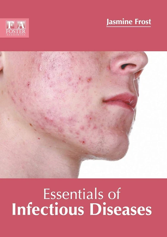 Essentials of Infectious Diseases