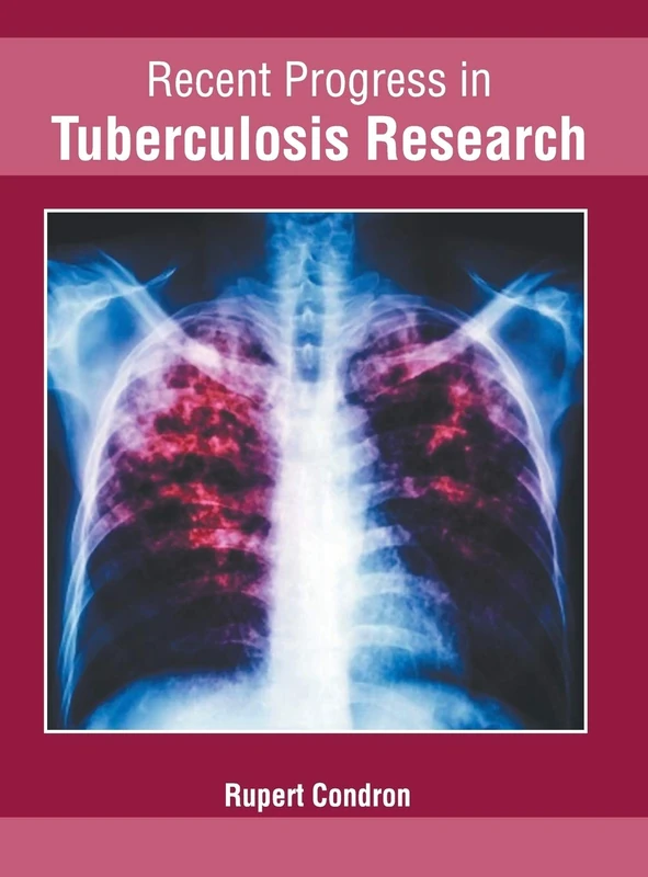 Recent Progress in Tuberculosis Research
