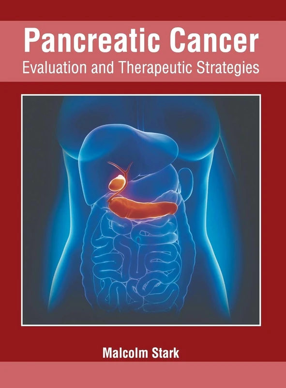 Pancreatic Cancer: Evaluation and Therapeutic Strategies