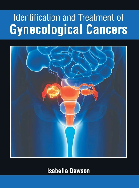Identification and Treatment of Gynecological Cancers