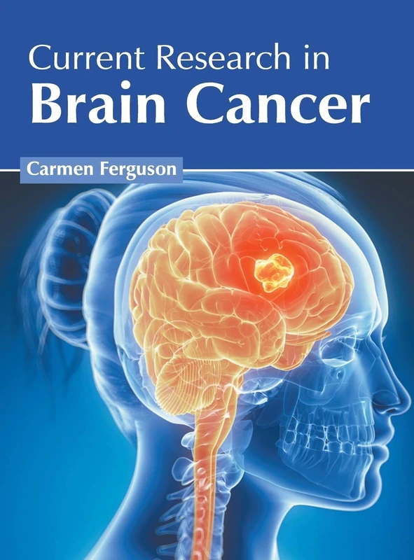 Foster Academics - Current Research in Brain Cancer Book