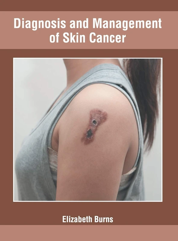 Diagnosis and Management of Skin Cancer