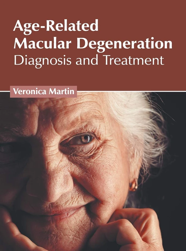 Age-Related Macular Degeneration: Diagnosis and Treatment