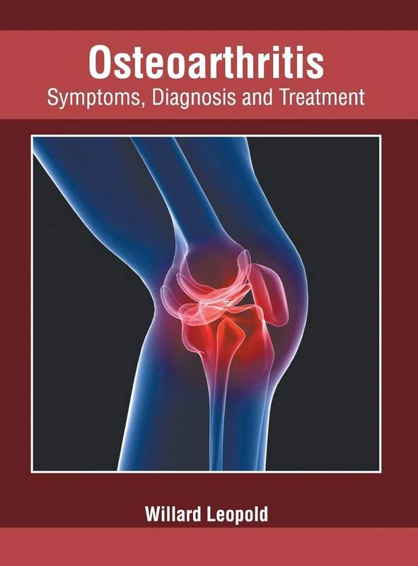 Osteoarthritis: Symptoms, Diagnosis and Treatment - Image 1
