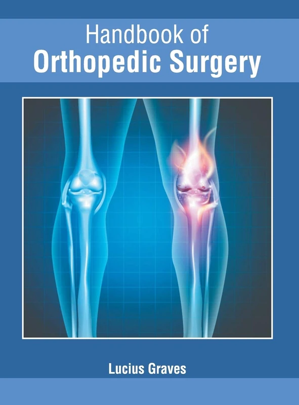 Handbook of Orthopedic Surgery