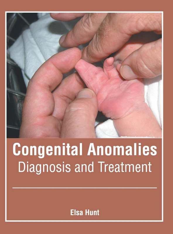 Congenital Anomalies: Diagnosis and Treatment