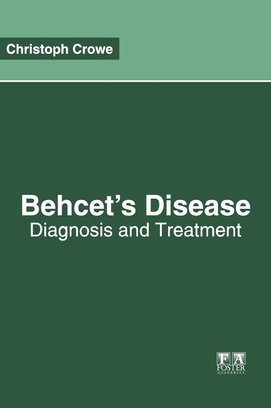 Behcet's Disease: Diagnosis and Treatment