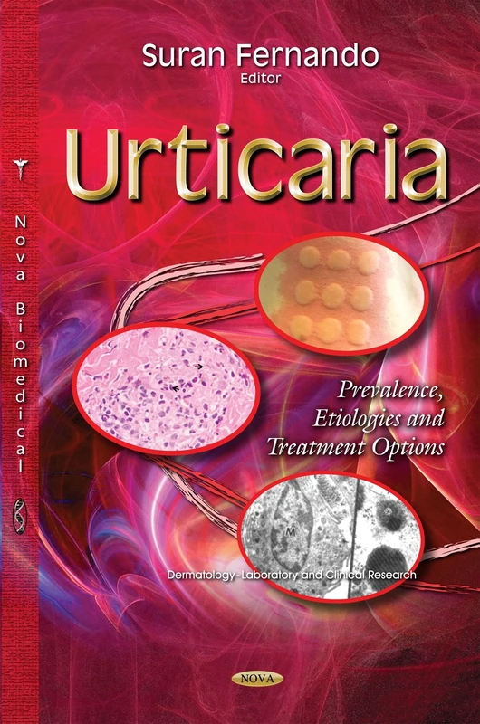 URTICARIA PREVALENCE ETIOLOGIES AND: Prevalence, Etiologies & Treatment Options (Dermatology - Laboratory and Clinical Research)