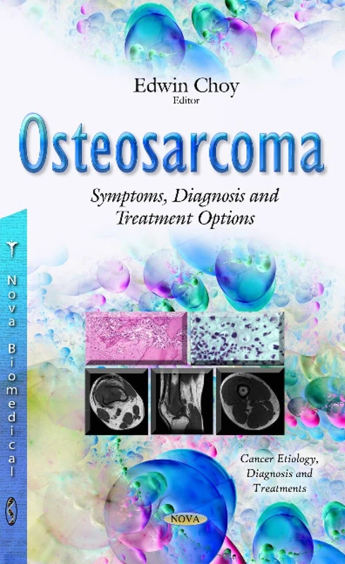 OSTEOSARCOMA SYMPTOMS DIAGNOSIS AND: Symptoms, Diagnosis & Treatment Options (Cancer Etiology, Diagnosis and Treatments)
