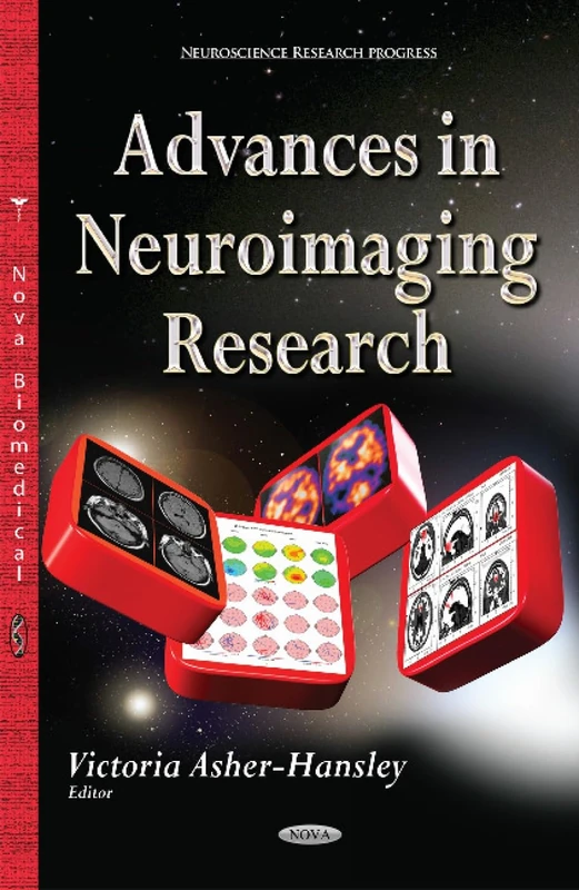 Advances in Neuroimaging Research (Neuroscience Research Progress) - Image 1