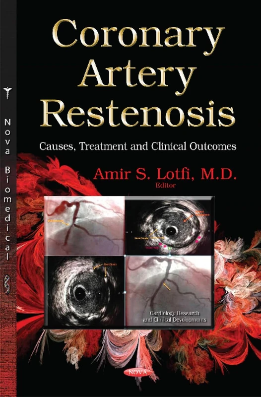 Coronary Artery Restenosis: Causes, Treatment and Clinical Outcomes (Cardiology Research and Clinical Developments)