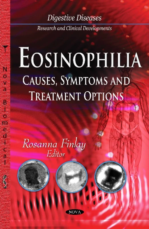 Eosinophilia: Causes, Symptoms and Treatment Options (Digestive Diseases - Research and Clinical Developments)