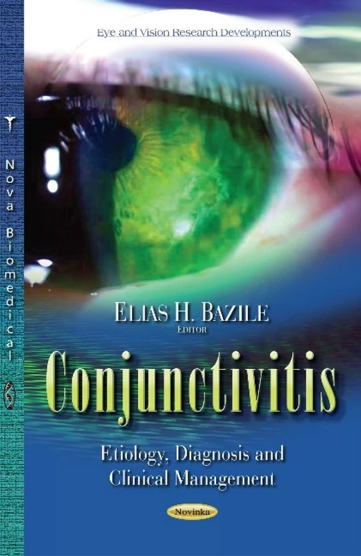 Conjunctivitis: Etiology, Diagnosis & Clinical Management