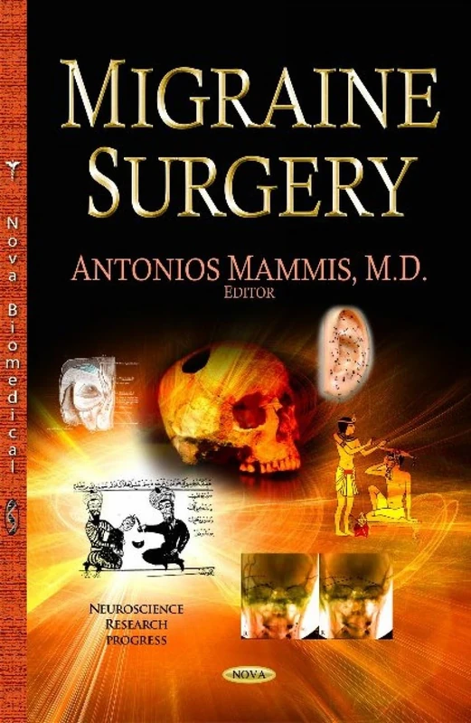 Migraine Surgery (Neuroscience Research Progress)